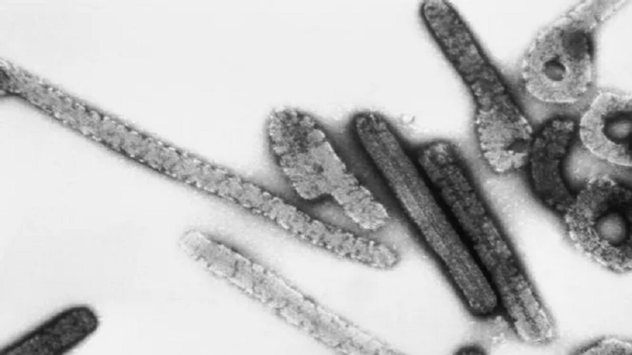 الصحة العالمية تحذر من خطر انتشار فيروس ماربورغ القاتل